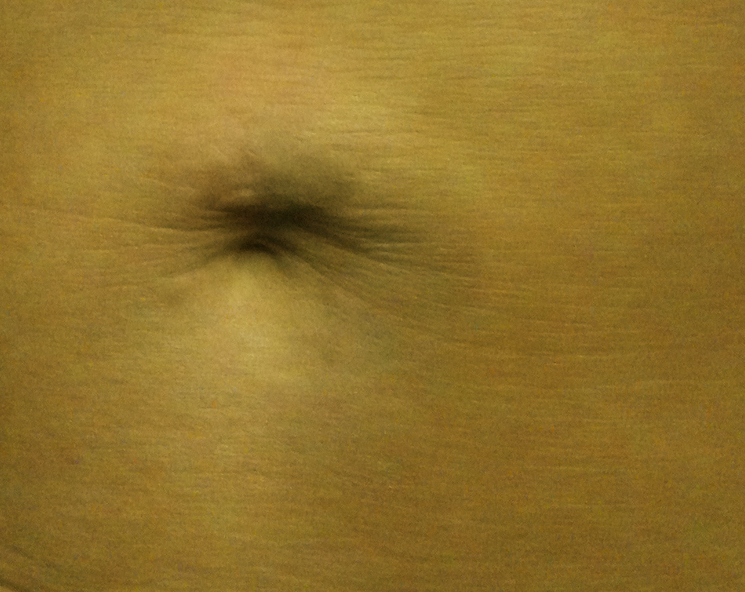 belly button after vampire face lift using Selphyl